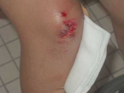 Lisa_Knie_25_07_2004_b